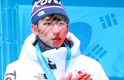 한국 첫 금메달, 쇼트트랙 남자 1,500ｍ 임효준